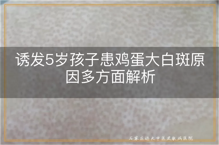 诱发5岁孩子患鸡蛋大白斑原因多方面解析