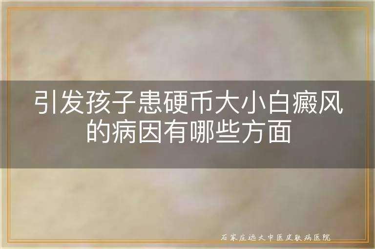 引发孩子患硬币大小白癜风的病因有哪些方面