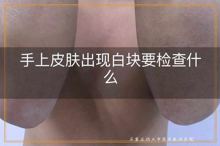 手上皮肤出现白块要检查什么