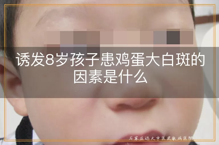 诱发8岁孩子患鸡蛋大白斑的因素是什么