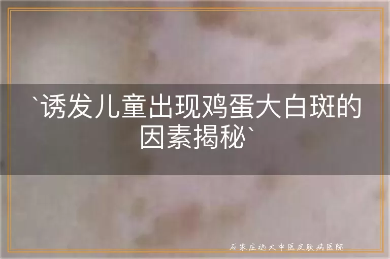 诱发儿童出现鸡蛋大白斑的因素揭秘