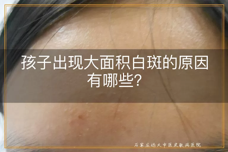 孩子出现大面积白斑的原因有哪些？