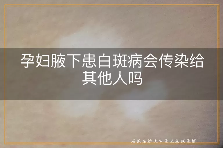 孕妇腋下患白斑病会传染给其他人吗