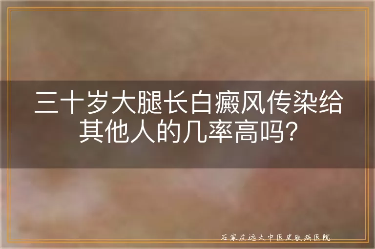 三十岁大腿长白癜风传染给其他人的几率高吗？