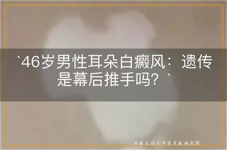 46岁男性耳朵白癜风：遗传是幕后推手吗？