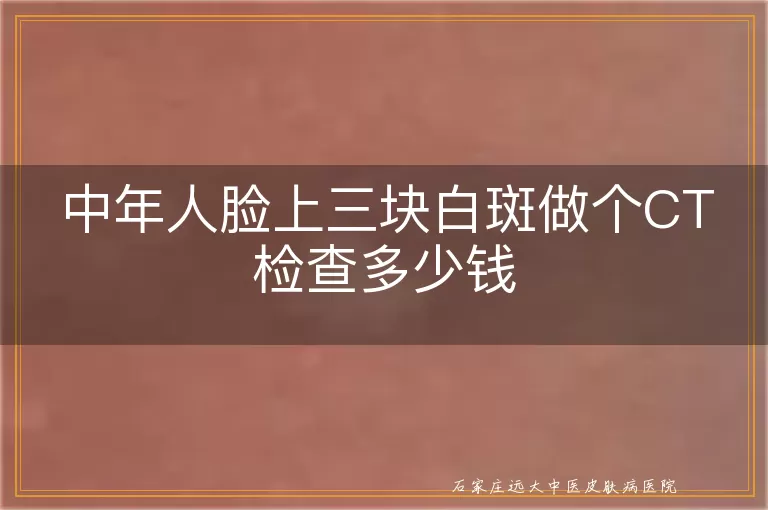 中年人脸上三块白斑做个CT检查多少钱