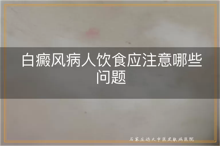 白癜风病人饮食应注意哪些问题