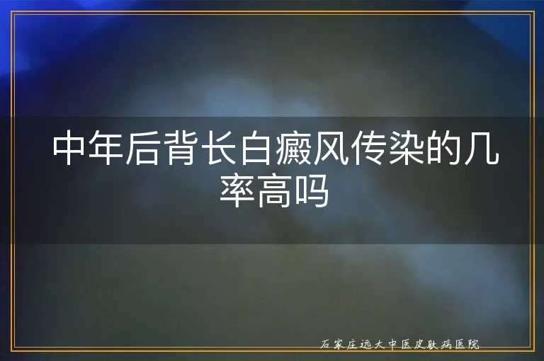 中年后背长白癜风传染的几率高吗