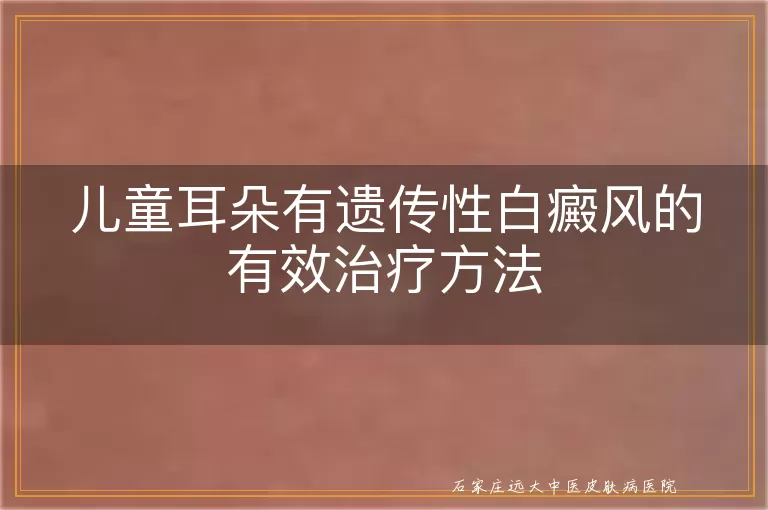 儿童耳朵有遗传性白癜风的有效治疗方法