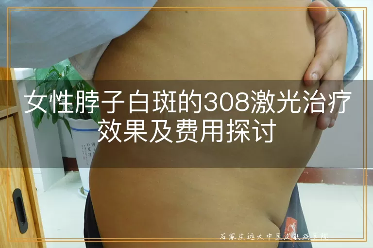 女性脖子白斑的308激光治疗效果及费用探讨