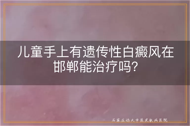 儿童手上有遗传性白癜风在邯郸能治疗吗？