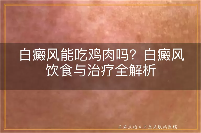 白癜风能吃鸡肉吗？白癜风饮食与治疗全解析