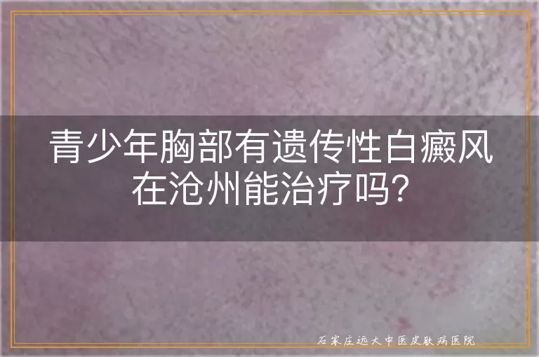 青少年胸部有遗传性白癜风在沧州能治疗吗？