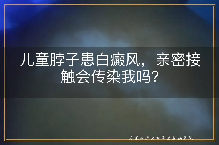 儿童脖子患白癜风，亲密接触会传染我吗？