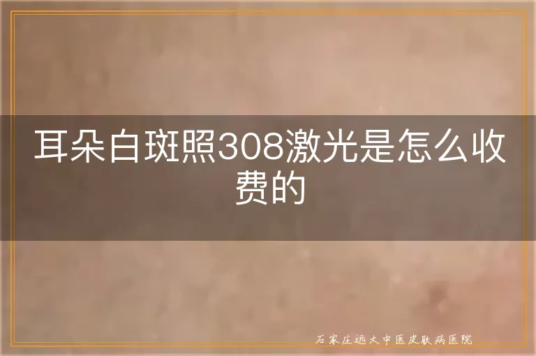 耳朵白斑照308激光是怎么收费的