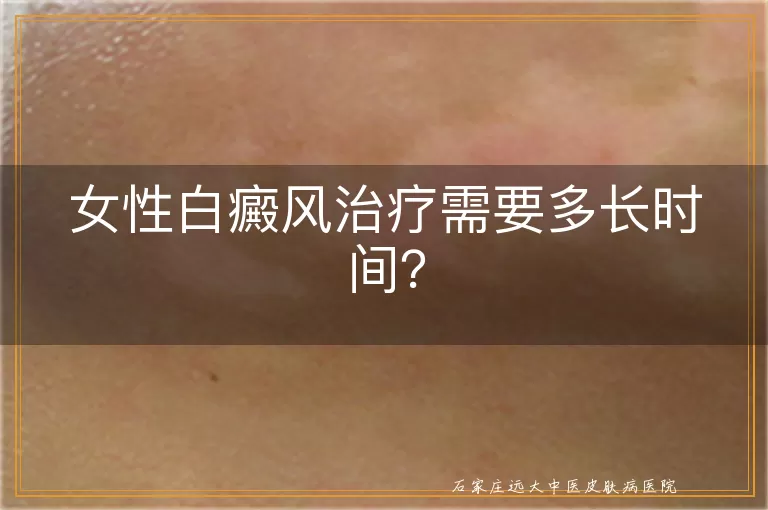 女性白癜风治疗需要多长时间？