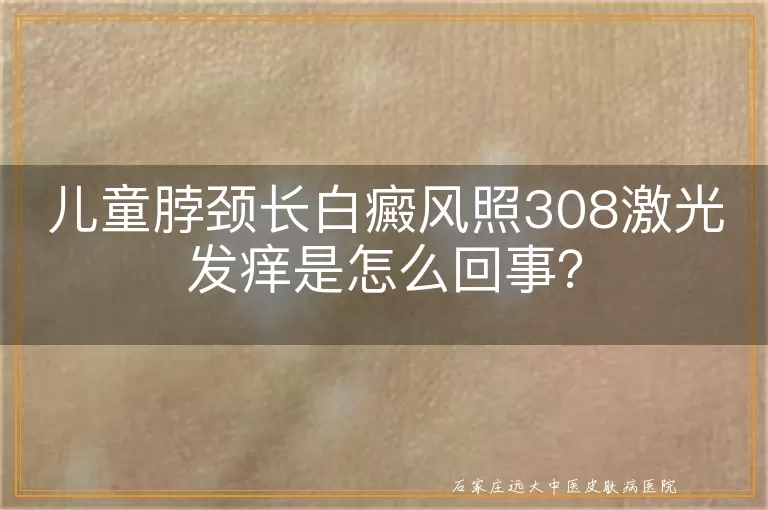 儿童脖颈长白癜风照308激光发痒是怎么回事？