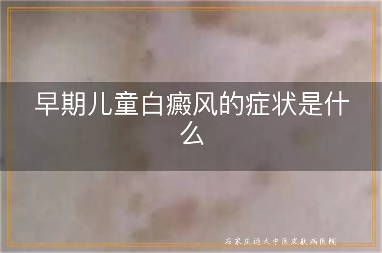 早期儿童白癜风的症状是什么