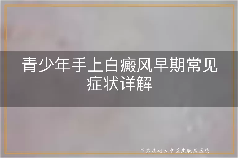 青少年手上白癜风早期常见症状详解