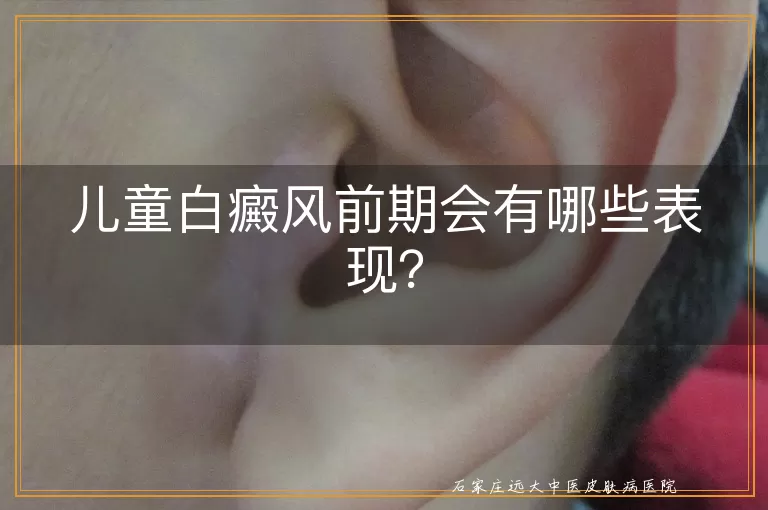 儿童白癜风前期会有哪些表现？