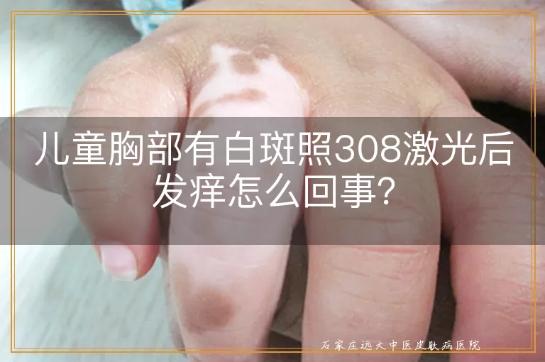 儿童胸部有白斑照308激光后发痒怎么回事？