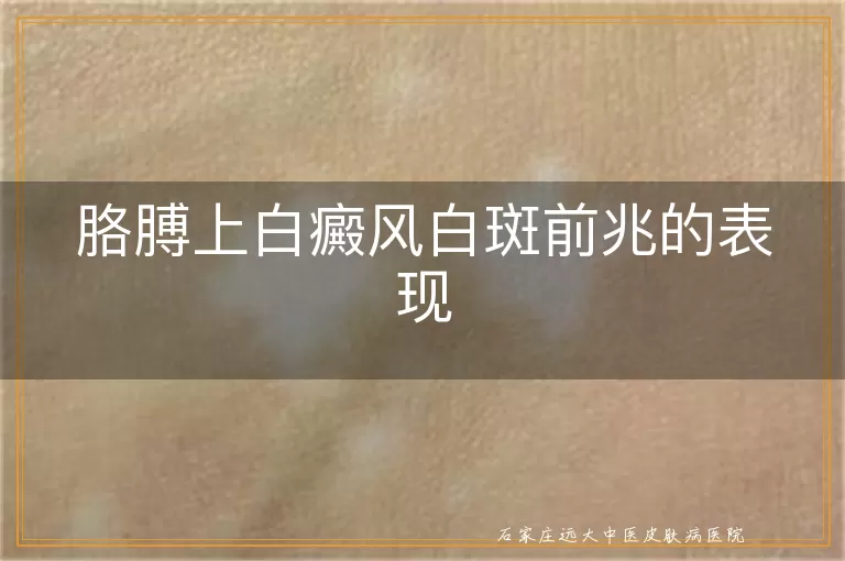 胳膊上白癜风白斑前兆的表现