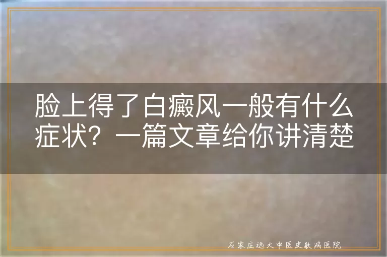 脸上得了白癜风一般有什么症状？一篇文章给你讲清楚！