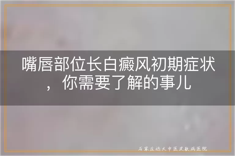 嘴唇部位长白癜风初期症状，你需要了解的事儿