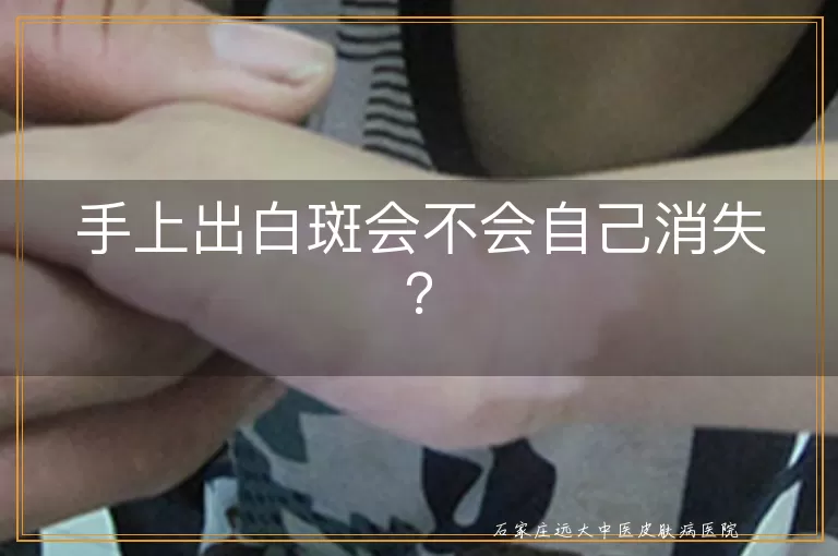 手上出白斑会不会自己消失？