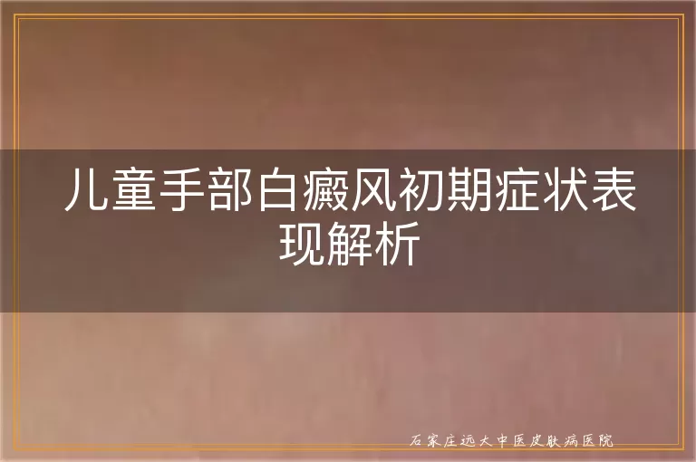 儿童手部白癜风初期症状表现解析