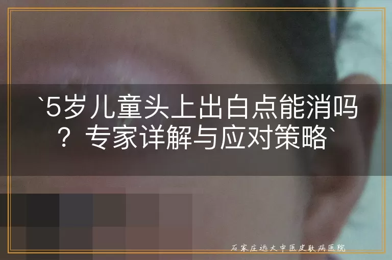 5岁儿童头上出白点能消吗？专家详解与应对策略