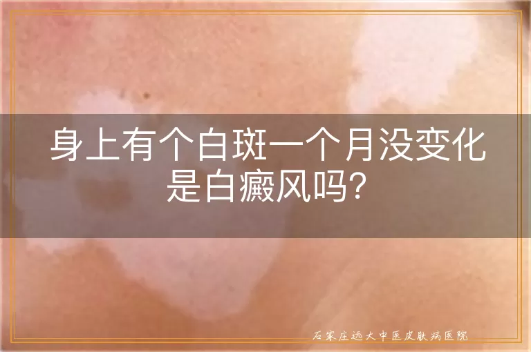 身上有个白斑一个月没变化是白癜风吗？