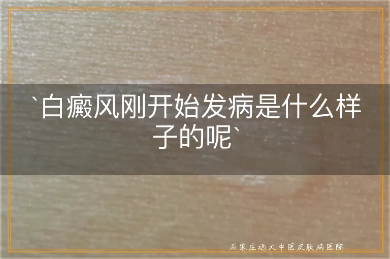 白癜风刚开始发病是什么样子的呢