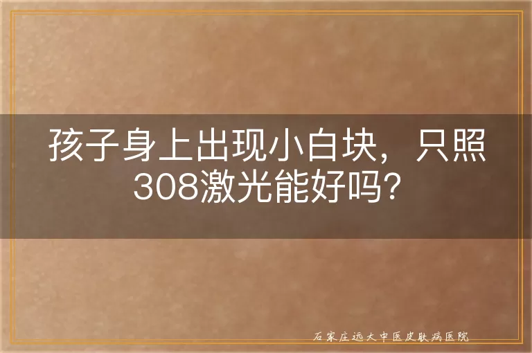 孩子身上出现小白块，只照308激光能好吗？