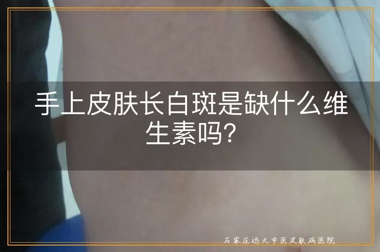 手上皮肤长白斑是缺什么维生素吗？