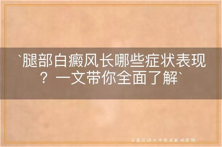 腿部白癜风长哪些症状表现？一文带你全面了解