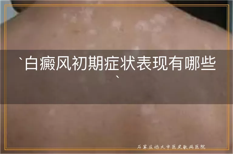 白癜风初期症状表现有哪些