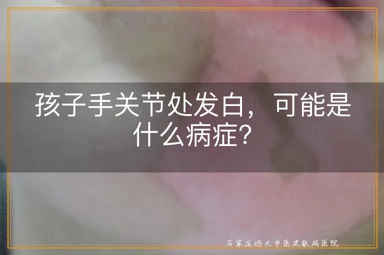 孩子手关节处发白，可能是什么病症？