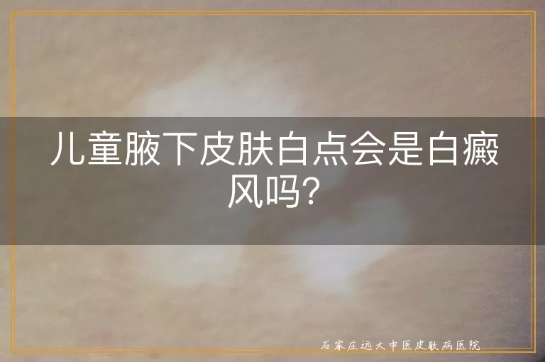 儿童腋下皮肤白点会是白癜风吗？