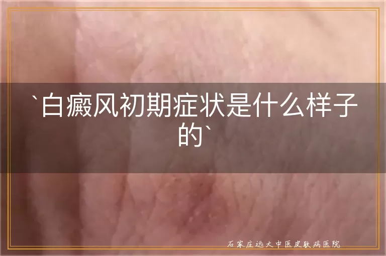 白癜风初期症状是什么样子的