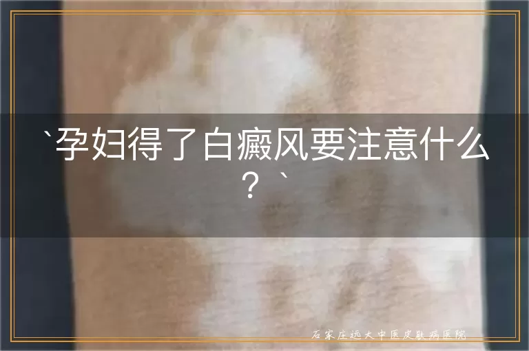 孕妇得了白癜风要注意什么？