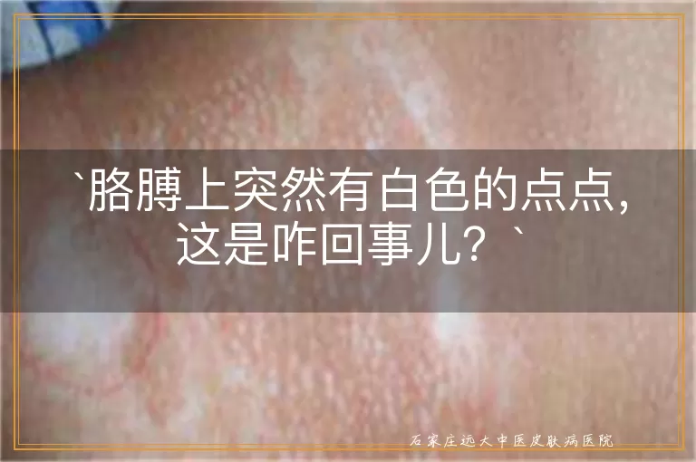 胳膊上突然有白色的点点，这是咋回事儿？