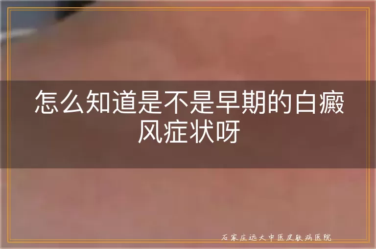 怎么知道是不是早期的白癜风症状呀