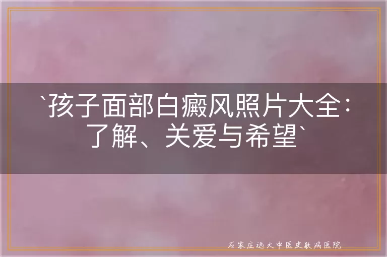 孩子面部白癜风照片大全：了解、关爱与希望