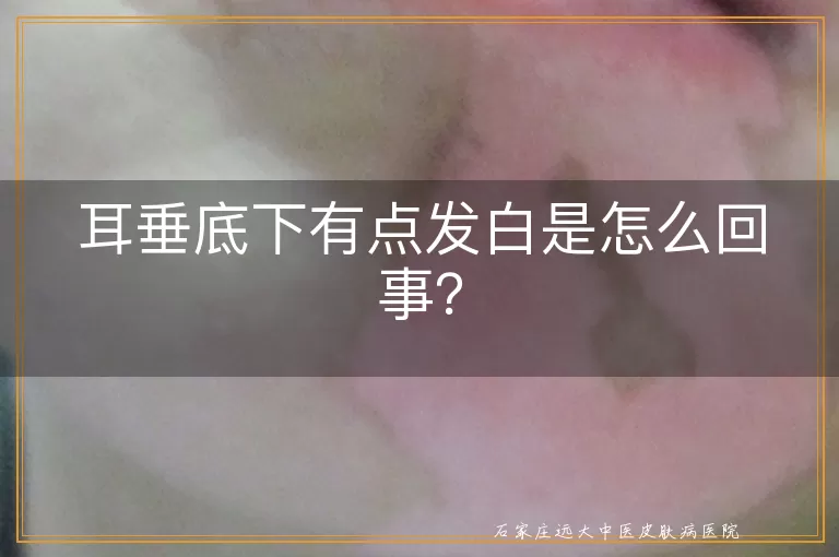 耳垂底下有点发白是怎么回事？