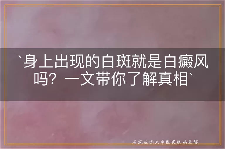 身上出现的白斑就是白癜风吗？一文带你了解真相