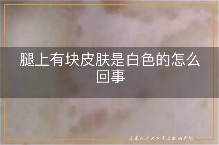 腿上有块皮肤是白色的怎么回事