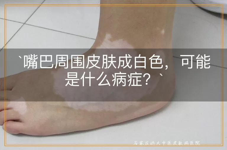 嘴巴周围皮肤成白色，可能是什么病症？