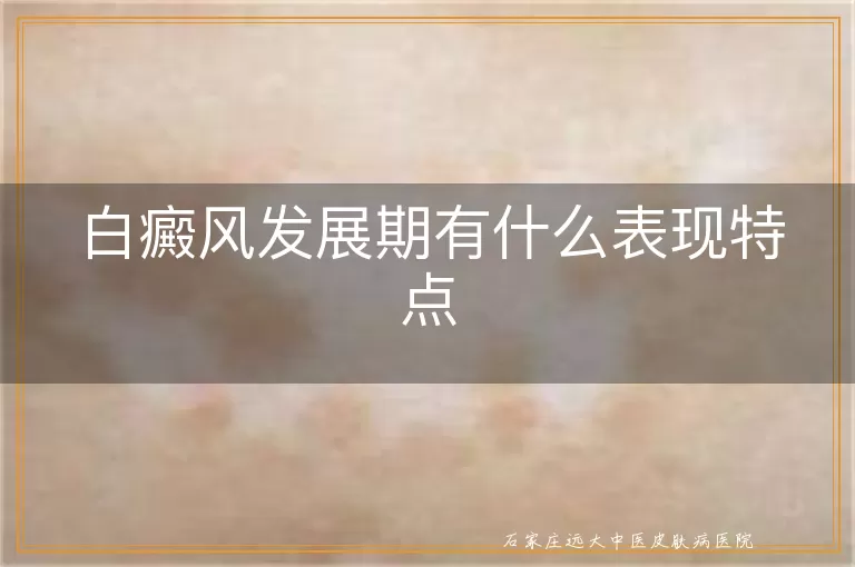 白癜风发展期有什么表现特点