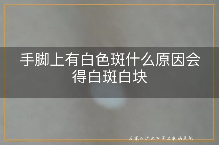 手脚上有白色斑什么原因会得白斑白块